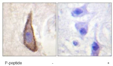 Immunohistochemistry (Formalin/PFA-fixed paraffin-embedded sections) - Anti-CD226 (phospho S329) antibody (AB61790)