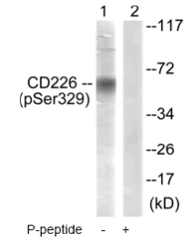 Western blot - Anti-CD226 (phospho S329) antibody (AB61790)