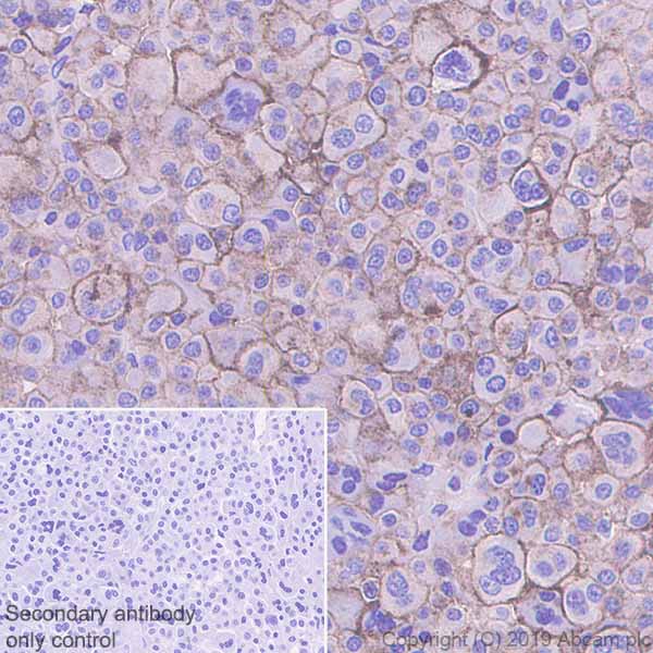 Immunohistochemistry (Formalin/PFA-fixed paraffin-embedded sections) - Anti-CD229 antibody [EPR22611-91] (AB252931), expandable thumbnail