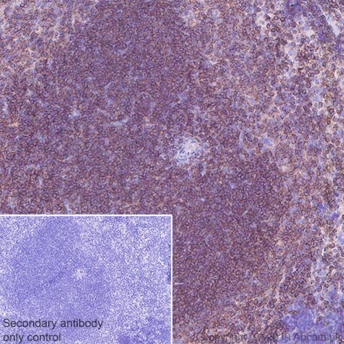 Immunohistochemistry (Formalin/PFA-fixed paraffin-embedded sections) - Anti-CD229 antibody [EPR22611-91] (AB252931), expandable thumbnail
