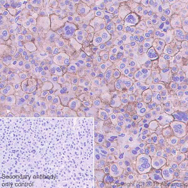 Immunohistochemistry (Formalin/PFA-fixed paraffin-embedded sections) - Anti-CD229 antibody [EPR22611-91] - BSA and Azide free (AB255280)