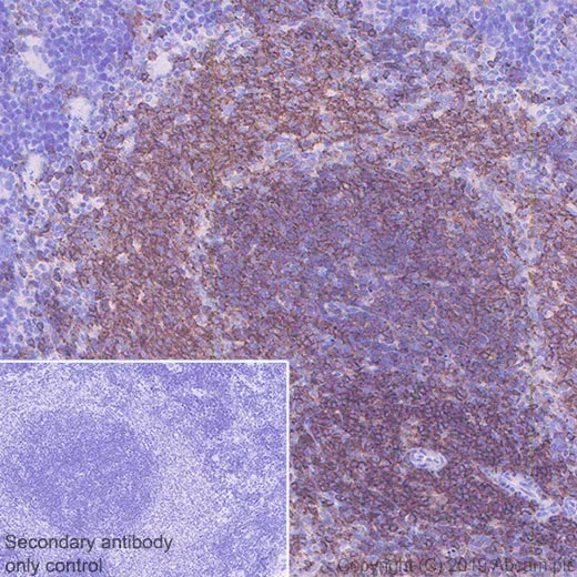 Immunohistochemistry (Formalin/PFA-fixed paraffin-embedded sections) - Anti-CD229 antibody [EPR22611-91] - BSA and Azide free (AB255280)