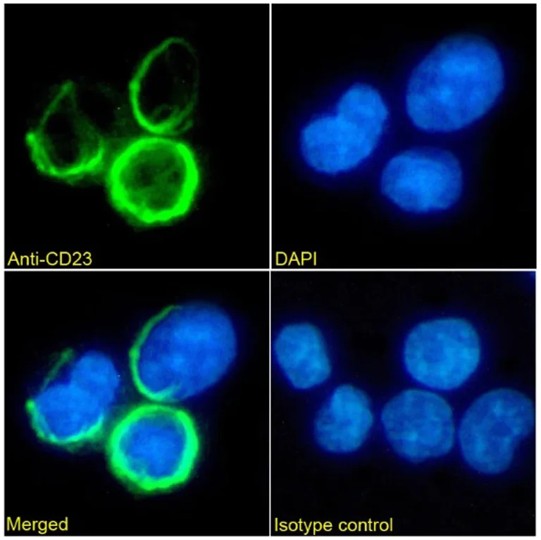 Immunocytochemistry/ Immunofluorescence - Anti-CD23 Antibody [Bu38] (AB316354)