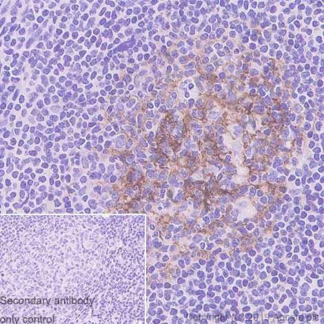 Immunohistochemistry (Formalin/PFA-fixed paraffin-embedded sections) - Anti-CD23 antibody [BU38] - BSA and Azide free (AB255918)