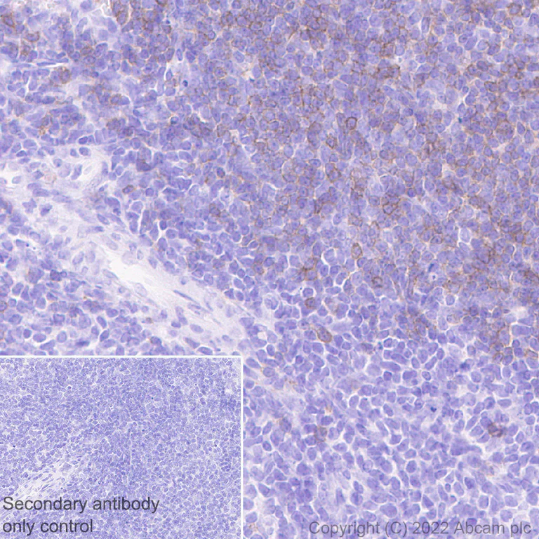 Immunohistochemistry (Formalin/PFA-fixed paraffin-embedded sections) - Anti-CD23 antibody [EPR26479-9] (AB302526)