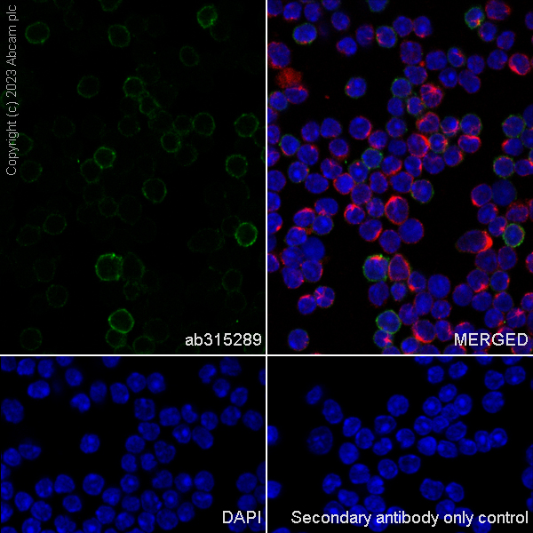 Immunocytochemistry/ Immunofluorescence - Anti-CD23 antibody [EPR28712-26] (AB315289), expandable thumbnail