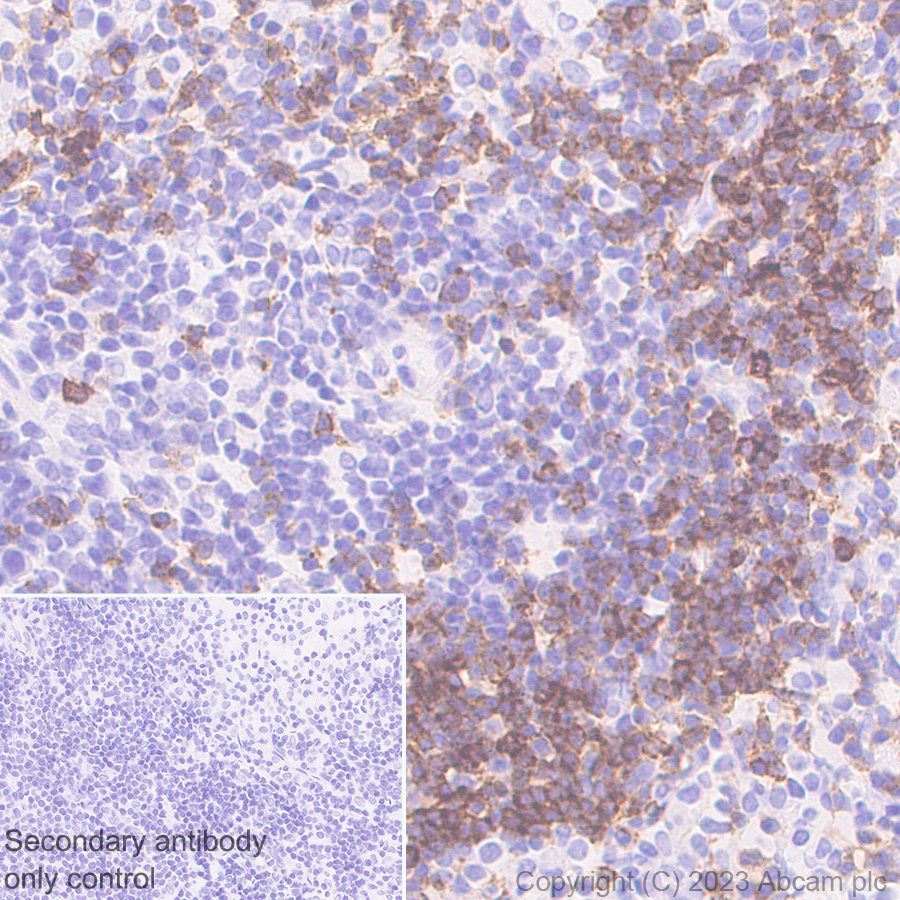 Immunohistochemistry (Formalin/PFA-fixed paraffin-embedded sections) - Anti-CD23 antibody [EPR28712-26] (ab315289), expandable thumbnail