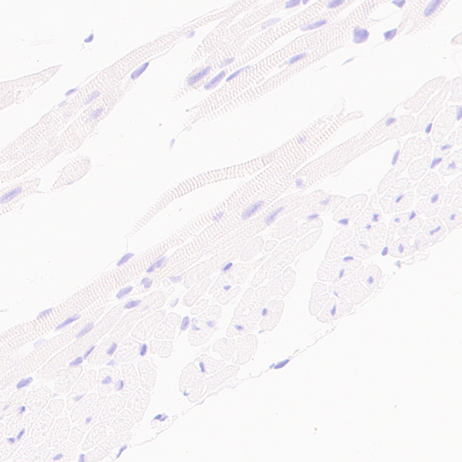 Immunohistochemistry (Formalin/PFA-fixed paraffin-embedded sections) - Anti-CD23 antibody [EPR28712-26] (ab315289), expandable thumbnail
