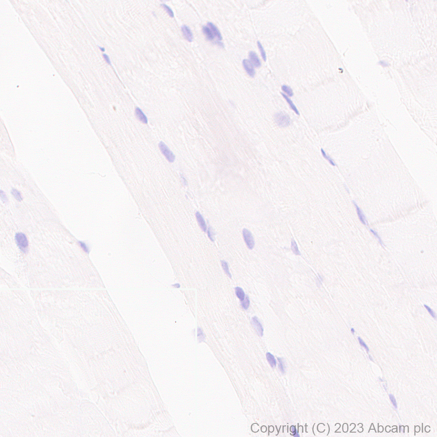 Immunohistochemistry (Formalin/PFA-fixed paraffin-embedded sections) - Anti-CD23 antibody [EPR28712-26] (AB315289), expandable thumbnail