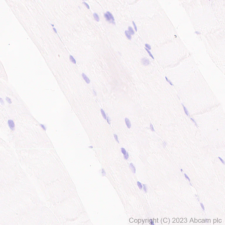 Immunohistochemistry (Formalin/PFA-fixed paraffin-embedded sections) - Anti-CD23 antibody [EPR28712-26] (AB315289)