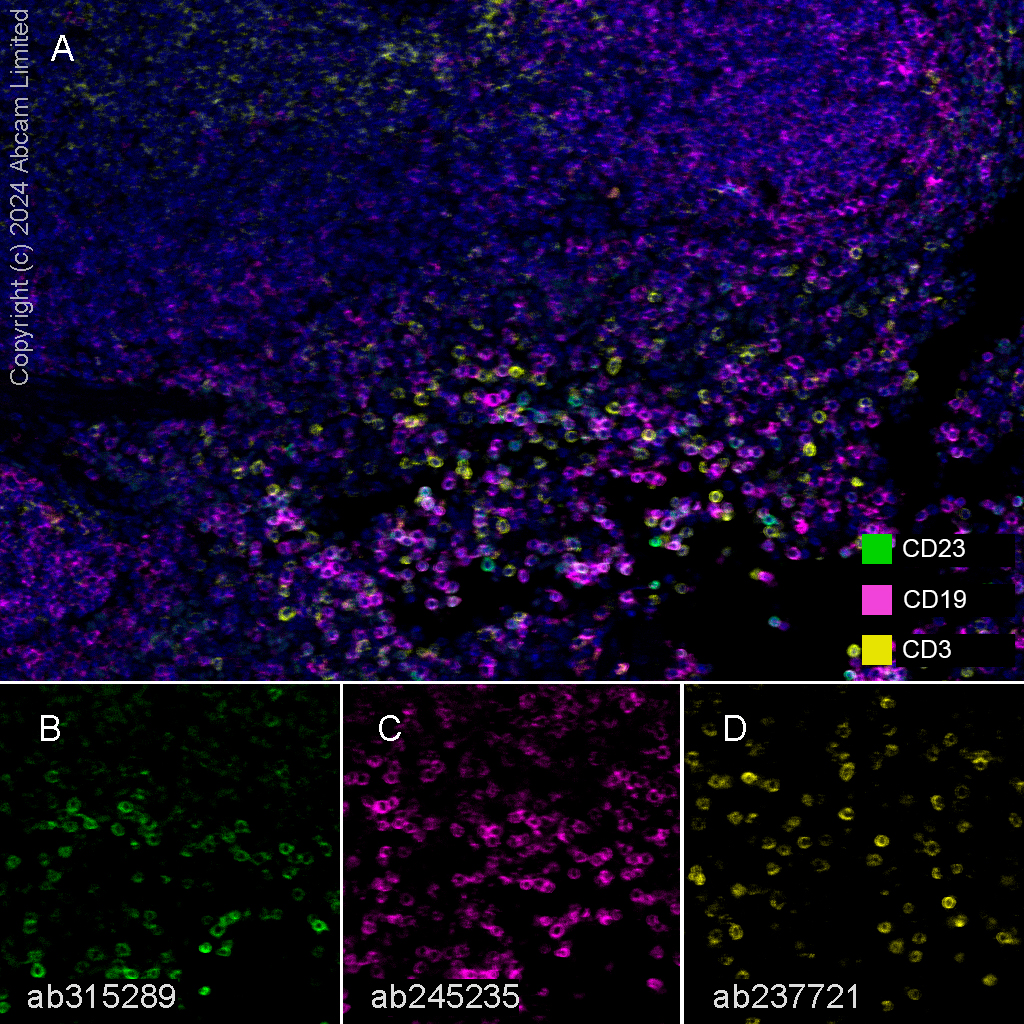 Multiplex immunohistochemistry - Anti-CD23 antibody [EPR28712-26] (AB315289), expandable thumbnail