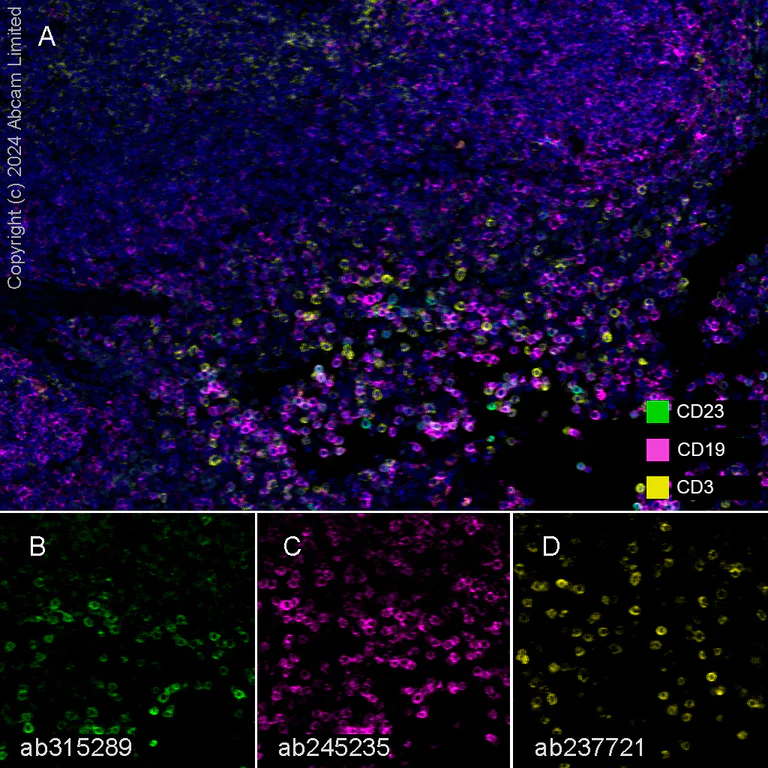 Multiplex immunohistochemistry - Anti-CD23 antibody [EPR28712-26] (AB315289)