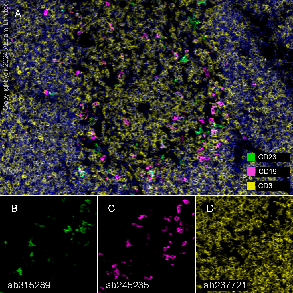 Multiplex immunohistochemistry - Anti-CD23 antibody [EPR28712-26] (AB315289), expandable thumbnail