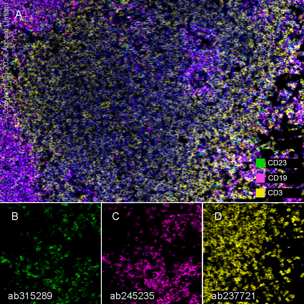 Multiplex immunohistochemistry - Anti-CD23 antibody [EPR28712-26] (AB315289), expandable thumbnail