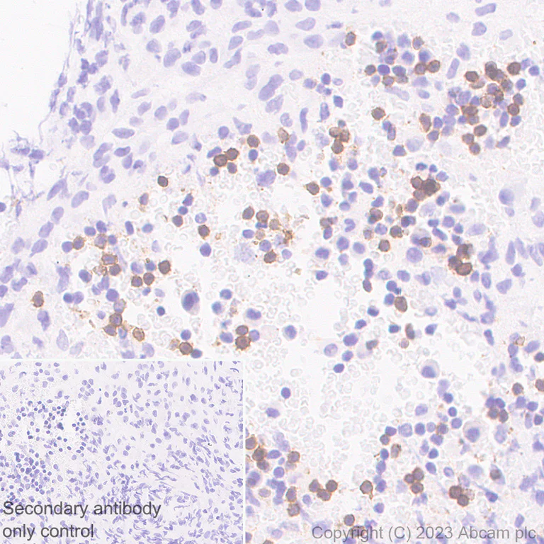 Immunohistochemistry (Formalin/PFA-fixed paraffin-embedded sections) - Anti-CD23 antibody [EPR28712-26] - BSA and Azide free (AB315290)