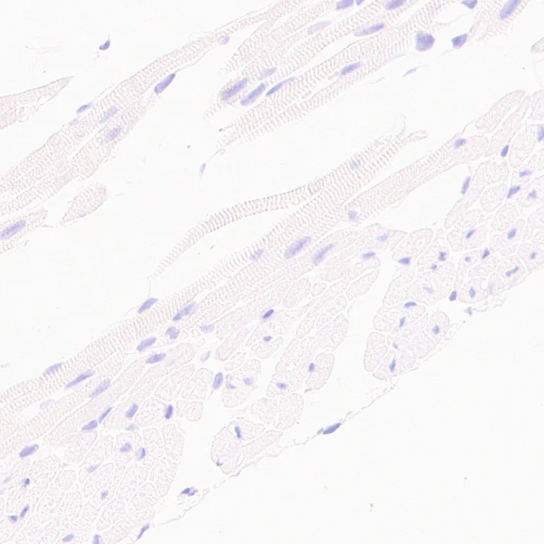 Immunohistochemistry (Formalin/PFA-fixed paraffin-embedded sections) - Anti-CD23 antibody [EPR28712-26] - BSA and Azide free (AB315290)