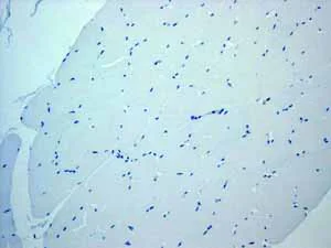 Immunohistochemistry (Formalin/PFA-fixed paraffin-embedded sections) - Anti-CD23 antibody [EPR3617] (AB92495)
