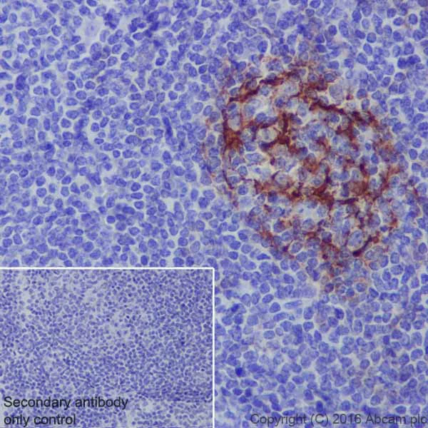 Immunohistochemistry (Formalin/PFA-fixed paraffin-embedded sections) - Anti-CD23 antibody [EPR3617] (AB92495)