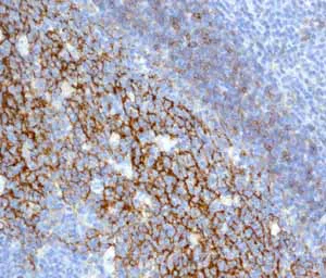 Immunohistochemistry (Formalin/PFA-fixed paraffin-embedded sections) - Anti-CD23 antibody [EPR3617] (AB92495)