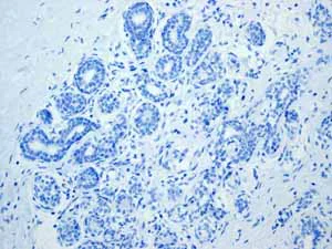 Immunohistochemistry (Formalin/PFA-fixed paraffin-embedded sections) - Anti-CD23 antibody [EPR3617] (AB92495)