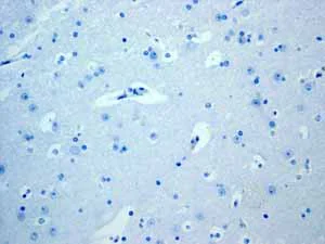 Immunohistochemistry (Formalin/PFA-fixed paraffin-embedded sections) - Anti-CD23 antibody [EPR3617] (AB92495)