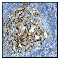 Immunohistochemistry (Formalin/PFA-fixed paraffin-embedded sections) - Anti-CD23 antibody [EPR3617] (AB92495)