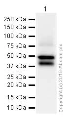 Western blot - Anti-CD23 antibody [EPR3617] (AB92495)