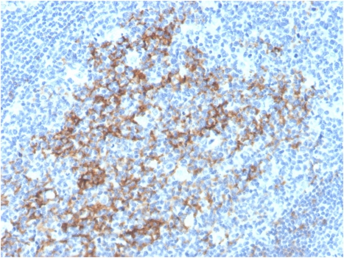Immunohistochemistry (Formalin/PFA-fixed paraffin-embedded sections) - Anti-CD23 antibody [FCER2/3592] (AB257306), expandable thumbnail