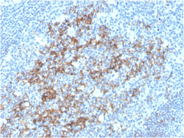 Immunohistochemistry (Formalin/PFA-fixed paraffin-embedded sections) - Anti-CD23 antibody [FCER2/3592] - BSA and Azide free (AB257323)