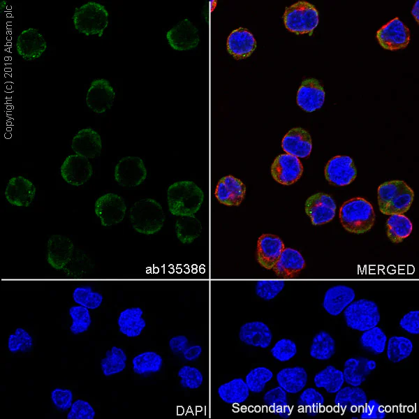 Immunocytochemistry/ Immunofluorescence - Anti-CD23 antibody [SP163] (AB135386)