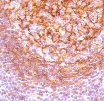 Immunohistochemistry (Formalin/PFA-fixed paraffin-embedded sections) - Anti-CD23 antibody [SP163] (AB135386)