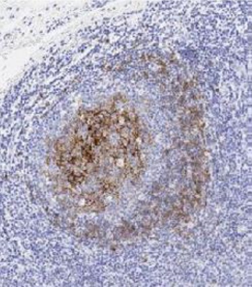 Immunohistochemistry (Formalin/PFA-fixed paraffin-embedded sections) - Anti-CD23 antibody [SP23] (AB16702), expandable thumbnail