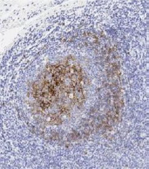 Immunohistochemistry (Formalin/PFA-fixed paraffin-embedded sections) - Anti-CD23 antibody [SP23] (AB16702)