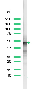 Western blot - Anti-CD23 antibody [SP23] (AB16702), expandable thumbnail