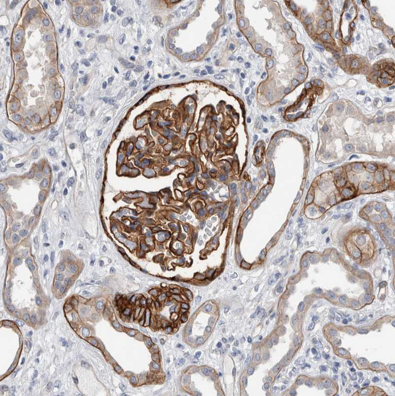 Immunohistochemistry (Formalin/PFA-fixed paraffin-embedded sections) - Anti-CD239/BCAM antibody (AB244280)