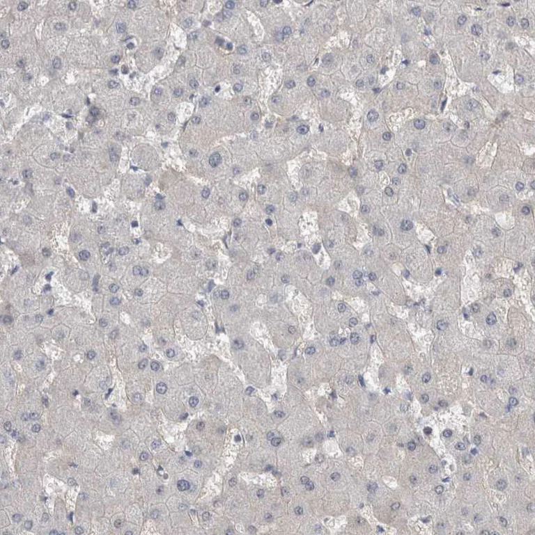 Immunohistochemistry (Formalin/PFA-fixed paraffin-embedded sections) - Anti-CD239/BCAM antibody (AB244280)