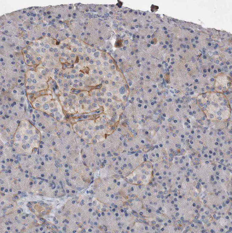 Immunohistochemistry (Formalin/PFA-fixed paraffin-embedded sections) - Anti-CD239/BCAM antibody (AB244280)