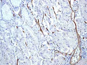 Immunohistochemistry (Formalin/PFA-fixed paraffin-embedded sections) - Anti-CD239/BCAM antibody [EPR4164] (AB111181)