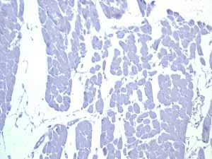 Immunohistochemistry (Formalin/PFA-fixed paraffin-embedded sections) - Anti-CD239/BCAM antibody [EPR4164] (AB111181)
