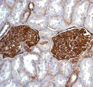 Immunohistochemistry (Formalin/PFA-fixed paraffin-embedded sections) - Anti-CD239/BCAM antibody [EPR4164] (AB111181)