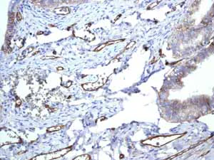 Immunohistochemistry (Formalin/PFA-fixed paraffin-embedded sections) - Anti-CD239/BCAM antibody [EPR4164] (AB111181)