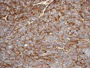 Immunohistochemistry (Formalin/PFA-fixed paraffin-embedded sections) - Anti-CD239/BCAM antibody [EPR4164] (AB111181)