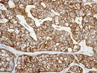 Immunohistochemistry (Formalin/PFA-fixed paraffin-embedded sections) - Anti-CD239/BCAM antibody [EPR4164] (AB111181)