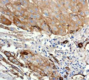 Immunohistochemistry (Formalin/PFA-fixed paraffin-embedded sections) - Anti-CD239/BCAM antibody [EPR4164] (AB111181)