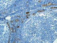Immunohistochemistry (Formalin/PFA-fixed paraffin-embedded sections) - Anti-CD239/BCAM antibody [EPR4164] - BSA and Azide free (AB247939)