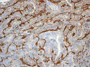 Immunohistochemistry (Formalin/PFA-fixed paraffin-embedded sections) - Anti-CD239/BCAM antibody [EPR4164] - BSA and Azide free (AB247939)