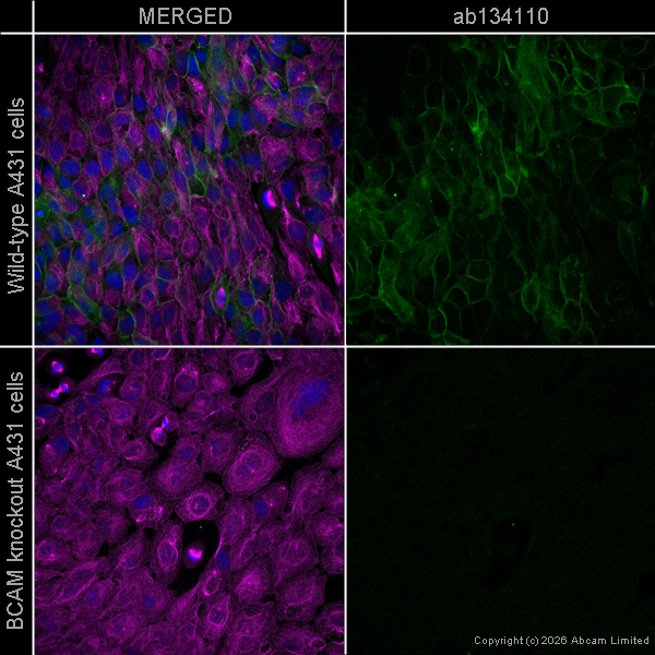 Immunocytochemistry - Anti-CD239/BCAM antibody [EPR4165] (AB134110)