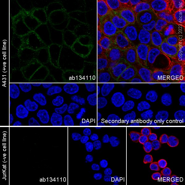 Immunocytochemistry/ Immunofluorescence - Anti-CD239/BCAM antibody [EPR4165] (AB134110)
