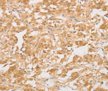 Immunohistochemistry (Formalin/PFA-fixed paraffin-embedded sections) - Anti-CD24 antibody (AB199140)