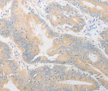 Immunohistochemistry (Formalin/PFA-fixed paraffin-embedded sections) - Anti-CD24 antibody (AB199140)